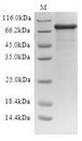 ALDP / ABCD1 Protein - (Tris-Glycine gel) Discontinuous SDS-PAGE (reduced) with 5% enrichment gel and 15% separation gel.