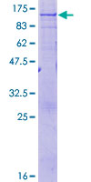 ALDP / ABCD1 Protein - 12.5% SDS-PAGE of human ABCD1 stained with Coomassie Blue