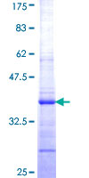 ALDP / ABCD1 Protein - 12.5% SDS-PAGE Stained with Coomassie Blue.