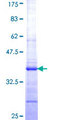 ALDP / ABCD1 Protein - 12.5% SDS-PAGE Stained with Coomassie Blue.