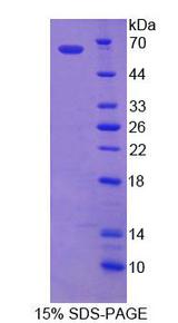 ALDP / ABCD1 Protein - Recombinant ATP Binding Cassette Transporter D1 (ABCD1) by SDS-PAGE