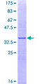 ALG1 Protein - 12.5% SDS-PAGE Stained with Coomassie Blue.