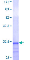 ALG10 / KCR1 Protein - 12.5% SDS-PAGE Stained with Coomassie Blue.