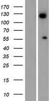 ALG11 Protein - Western validation with an anti-DDK antibody * L: Control HEK293 lysate R: Over-expression lysate