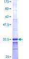 ALG12 Protein - 12.5% SDS-PAGE Stained with Coomassie Blue.