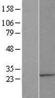 ALG14 Protein - Western validation with an anti-DDK antibody * L: Control HEK293 lysate R: Over-expression lysate