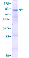 ALG2 Protein - 12.5% SDS-PAGE of human ALG2 stained with Coomassie Blue