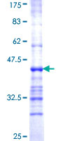ALG2 Protein - 12.5% SDS-PAGE Stained with Coomassie Blue.