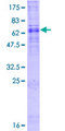 ALG3 / NOT Protein - 12.5% SDS-PAGE of human ALG3 stained with Coomassie Blue