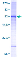 ALG5 Protein - 12.5% SDS-PAGE of human ALG5 stained with Coomassie Blue
