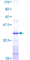 ALG5 Protein - 12.5% SDS-PAGE Stained with Coomassie Blue.
