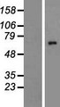 ALG8 Protein - Western validation with an anti-DDK antibody * L: Control HEK293 lysate R: Over-expression lysate