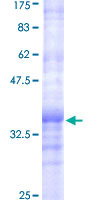 ALG8 Protein - 12.5% SDS-PAGE Stained with Coomassie Blue.