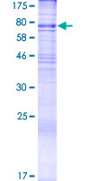 ALG9 Protein - 12.5% SDS-PAGE of human ALG9 stained with Coomassie Blue