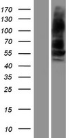 ALK-6 / BMPR1B Protein - Western validation with an anti-DDK antibody * L: Control HEK293 lysate R: Over-expression lysate