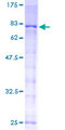 ALK-6 / BMPR1B Protein - 12.5% SDS-PAGE of human BMPR1B stained with Coomassie Blue