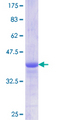 ALK-6 / BMPR1B Protein - 12.5% SDS-PAGE Stained with Coomassie Blue.