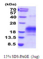 ALK-6 / BMPR1B Protein
