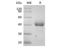 ALK2 / ACVR1 Protein - Recombinant Human Activin RIA/ALK-2 (C-Fc)