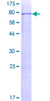 ALK2 / ACVR1 Protein - 12.5% SDS-PAGE of human ACVR1 stained with Coomassie Blue
