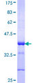 ALK2 / ACVR1 Protein - 12.5% SDS-PAGE Stained with Coomassie Blue.
