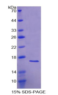 ALK2 / ACVR1 Protein - Recombinant Activin A Receptor Type I By SDS-PAGE