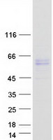 ALK2 / ACVR1 Protein - Purified recombinant protein ACVR1 was analyzed by SDS-PAGE gel and Coomassie Blue Staining