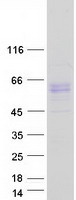 ALK2 / ACVR1 Protein - Purified recombinant protein ACVR1 was analyzed by SDS-PAGE gel and Coomassie Blue Staining