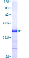 ALK3 / BMPR1A Protein - 12.5% SDS-PAGE Stained with Coomassie Blue.
