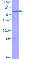 ALKBH1 / ALKB Protein - 12.5% SDS-PAGE of human ALKBH stained with Coomassie Blue
