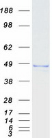 ALKBH1 / ALKB Protein - Purified recombinant protein ALKBH1 was analyzed by SDS-PAGE gel and Coomassie Blue Staining
