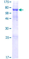 ALKBH5 Protein - 12.5% SDS-PAGE of human ALKBH5 stained with Coomassie Blue