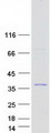 ALKBH6 Protein - Purified recombinant protein ALKBH6 was analyzed by SDS-PAGE gel and Coomassie Blue Staining