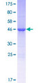 ALKBH7 Protein - 12.5% SDS-PAGE of human ALKBH7 stained with Coomassie Blue