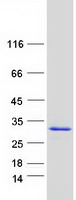 ALKBH7 Protein - Purified recombinant protein ALKBH7 was analyzed by SDS-PAGE gel and Coomassie Blue Staining