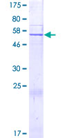 ALKBH8 Protein - 12.5% SDS-PAGE of human ALKBH8 stained with Coomassie Blue
