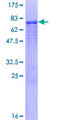 ALLC Protein - 12.5% SDS-PAGE of human ALLC stained with Coomassie Blue