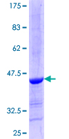 ALLC Protein - 12.5% SDS-PAGE Stained with Coomassie Blue.