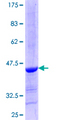 ALLC Protein - 12.5% SDS-PAGE Stained with Coomassie Blue.