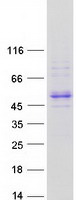 ALLC Protein - Purified recombinant protein ALLC was analyzed by SDS-PAGE gel and Coomassie Blue Staining