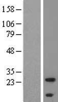 ALMS1 Protein - Western validation with an anti-DDK antibody * L: Control HEK293 lysate R: Over-expression lysate