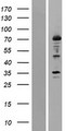 ALOX12 / 12 Lipoxygenase Protein - Western validation with an anti-DDK antibody * L: Control HEK293 lysate R: Over-expression lysate