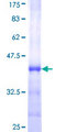 ALOX12 / 12 Lipoxygenase Protein - 12.5% SDS-PAGE Stained with Coomassie Blue.