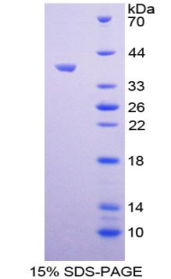 ALOX12 / 12 Lipoxygenase Protein - Recombinant Arachidonate-12-Lipoxygenase By SDS-PAGE