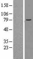ALOX12B Protein - Western validation with an anti-DDK antibody * L: Control HEK293 lysate R: Over-expression lysate