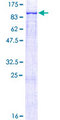 ALOX12B Protein - 12.5% SDS-PAGE of human ALOX12B stained with Coomassie Blue