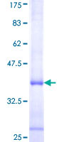 ALOX12B Protein - 12.5% SDS-PAGE Stained with Coomassie Blue.
