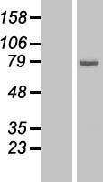 ALOX15 / 15-Lipoxygenase Protein - Western validation with an anti-DDK antibody * L: Control HEK293 lysate R: Over-expression lysate