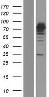 ALOX15B / 15-LOX-2 Protein - Western validation with an anti-DDK antibody * L: Control HEK293 lysate R: Over-expression lysate