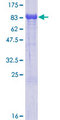 ALOX15B / 15-LOX-2 Protein - 12.5% SDS-PAGE of human ALOX15B stained with Coomassie Blue